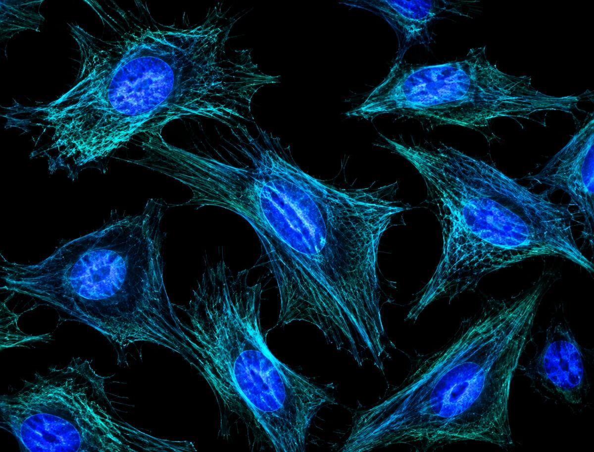 Fluorescence microscopy of cells